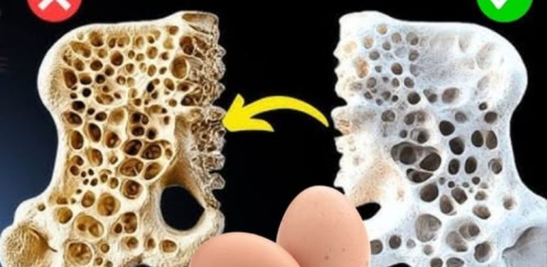 Varování před osteoporózou: 16 potravin č. 1, které zlepšují vaše slabé kosti (jak je jíst)