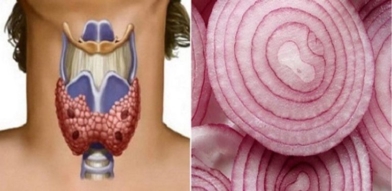 Červená cibule může udělat zázraky pro štítnou žlázu – jak ji správně používat…
