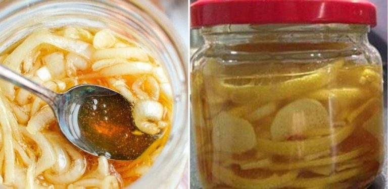 Dej cibuli, citron, zázvor a med do sklenice a zapomeň na kašel a zápal plic. Recept, který zahání jakoukoli nemoc…