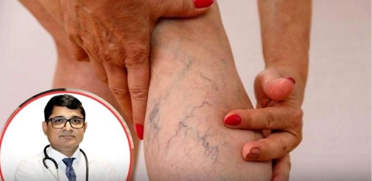Vaše nohy mohou signalizovat vysokou hladinu cukru v krvi! Pokud často zaznamenáte těchto 10 podivných příznaků, dávejte si pozor na cukrovku.