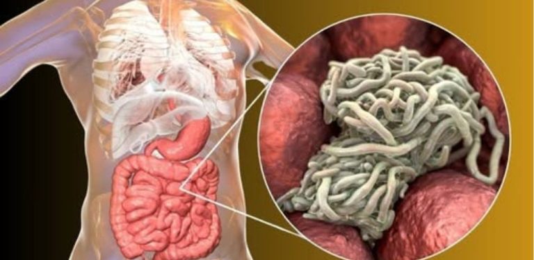 Eliminujte střevní parazity přirozeným způsobem: Účinný recept s hřebíčkem a lněným semínkem