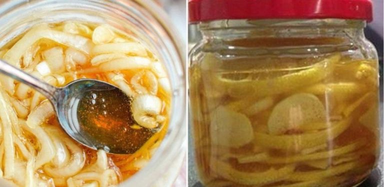 Dej cibuli, citron, zázvor a med do sklenice a zapomeň na kašel a zápal plic. Recept, který zahání jakoukoli nemoc…