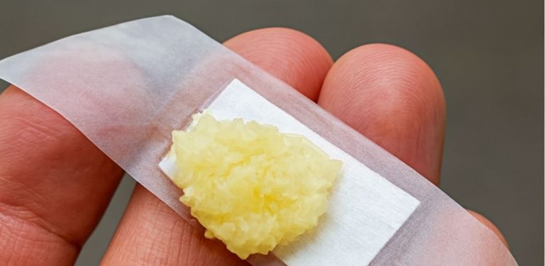 Přírodní metody proti stařeckým skvrnám, mateřským znaménkům a bradavicím