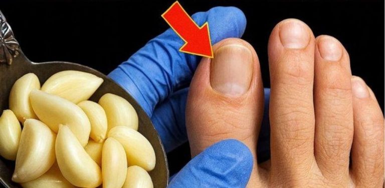 Jak pečovat o nehty přirozeným způsobem: síla česneku v domácí péči