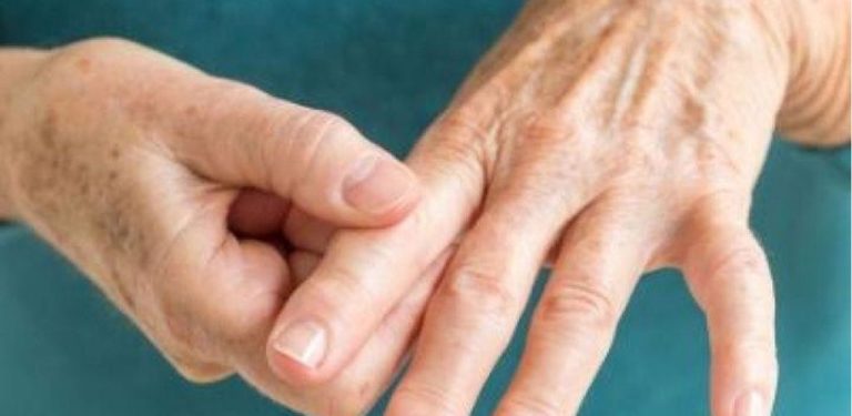 Takto můžete nejrychleji odstranit kyselinu močovou z těla, aby zmizel dna a bolesti kloubů.