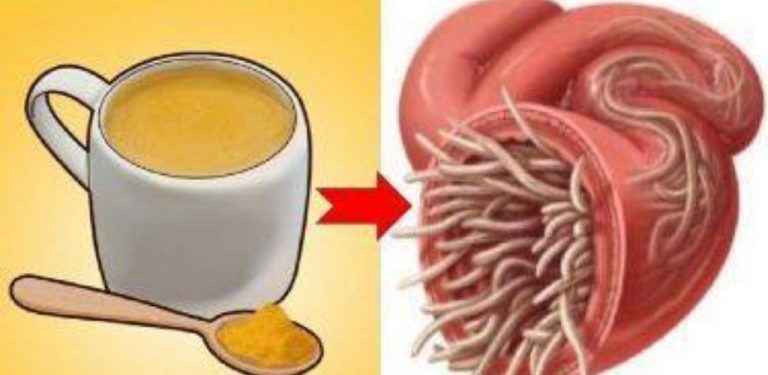 7 potravin, které zabíjejí červy ve vašich střevech