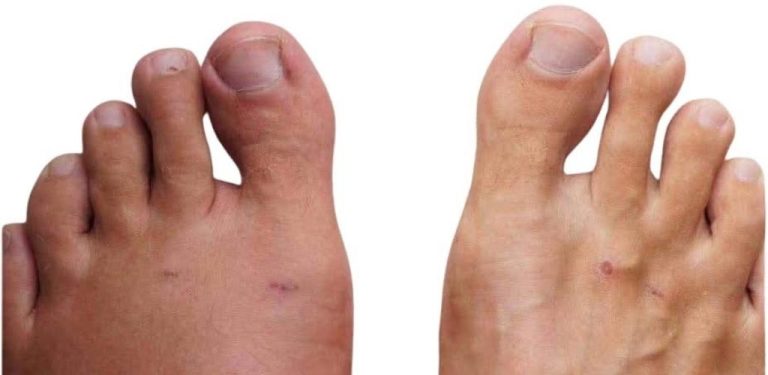 Lékaři varují: před infarktem vás vaše tělo upozorní těmito 7 ČERVENÝMI SIGNÁLY