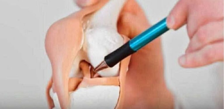 6 potravin, které tiše odčerpávají vápník z těla – čím více jich jíš, tím slabší jsou tvé kosti