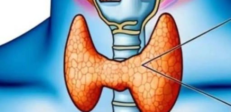 3 varovné příznaky rakoviny štítné žlázy, které byste neměli ignorovat