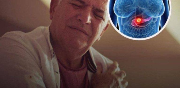 Rakovina slinivky břišní: Dva časné příznaky často smrtelného onemocnění rakovinou