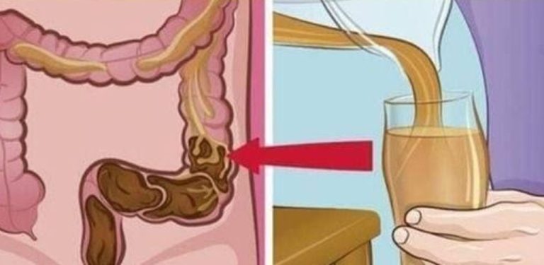 Je možné odstranit 7 kg „odpadu“ z tlustého střeva za jednu noc? Pravda o čištění střev