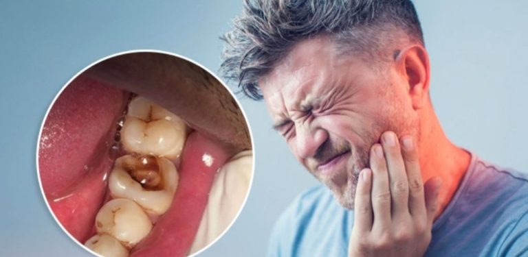 Deset tipů, jak se vyhnout zubnímu ošetřeníJak léčit přirozený zubní kaz