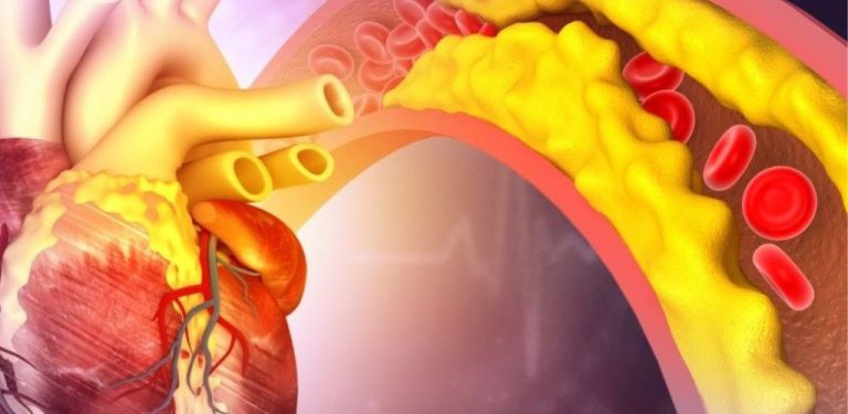 Proč je oves klíčovým spojencem v kontrole hladiny cholesterolu, trávení a sytosti