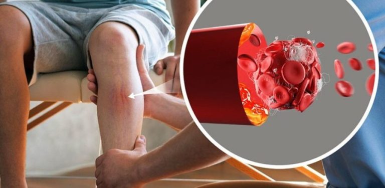 Bojuje proti cukrovce, vysokému krevnímu tlaku, bolestem kůže, cholesterolu a poruchám krevního oběhu.