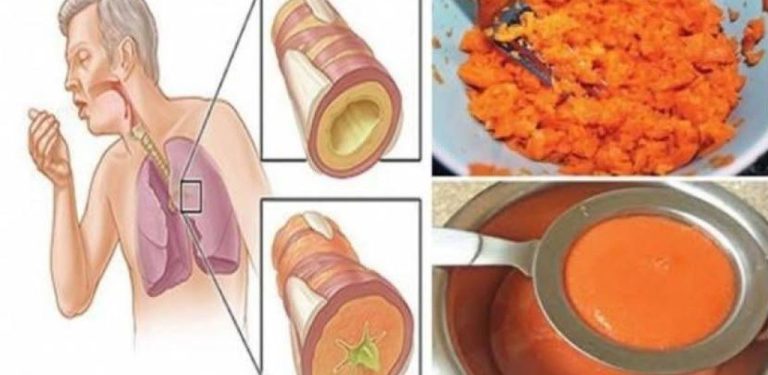 Domácí sirup proti kašli, který během několika hodin pomůže odstranit nahromaděné hleny.