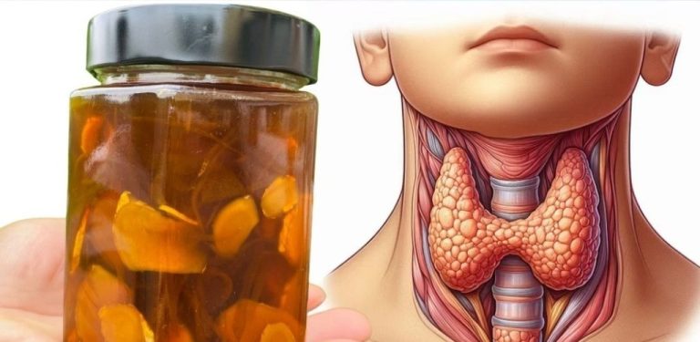VYLÉČÍ VAŠI ŠTÍTNOU ŽLÁZU ZA POUHÉ 3 DNY! Recept na koupel s kurkumou od Barbary O’Neillové.
