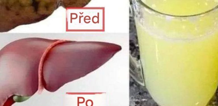 5 nápojů před spaním, které čistí játra a spalují tuky