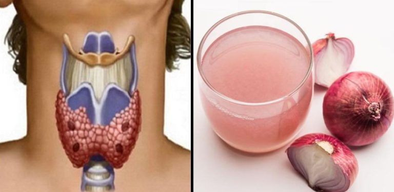 Červená cibule dokáže s štítnou žlázou zázraky (jak ji správně používat)…