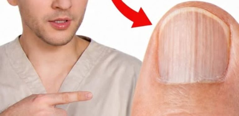 Příroda ti dala ukazatel nemocí, ale 99 % lidí ho nevyužívá. Co se ti snaží říct tvé nehty?