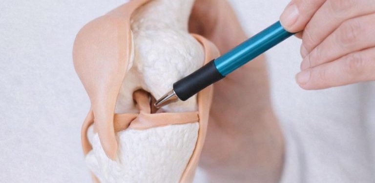 6 potravin, které tělu tiše odčerpávají vápník – čím více jich jíte, tím slabší jsou vaše kosti