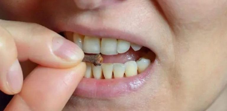 20 skvělých způsobů, jak využít hřebíček pro vaše zdraví
