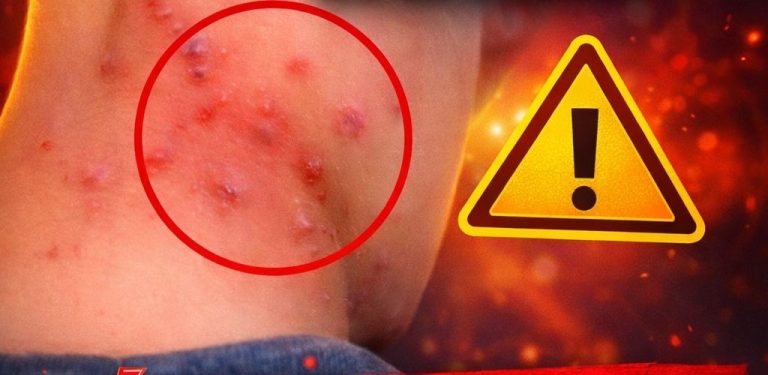 Znáte hlavní druhy kožních vyrážek? Zjistěte, jaké jsou a co je způsobuje.