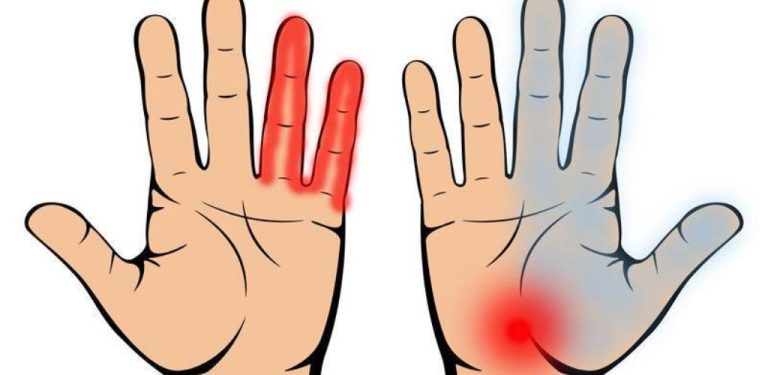 7 závažných onemocnění, na která vás může upozornit vaše dlaň