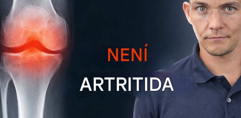 Skutečný důvod, proč se ti bolest kolene stále vrací (50+)